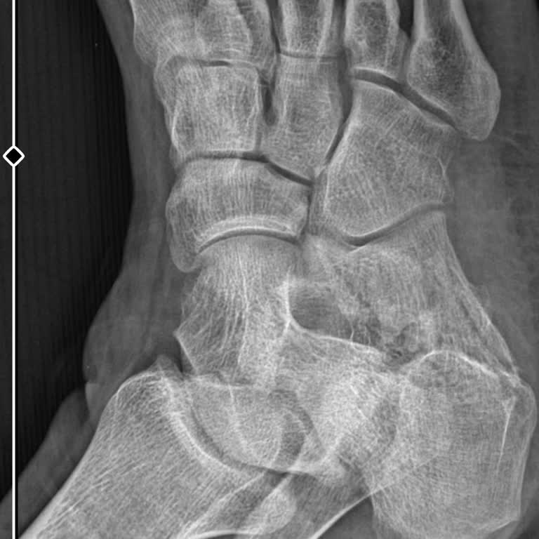 Acil Serviste Yanlış Teşhis Mağduriyeti