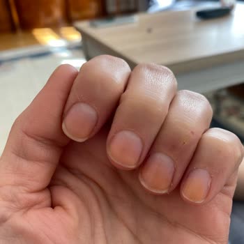 Flormar Oje Sonrası Tırnak Sorunu