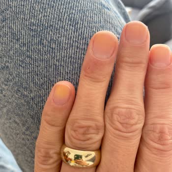 Flormar Oje Sonrası Tırnak Sorunu