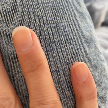 Flormar Oje Sonrası Tırnak Sorunu