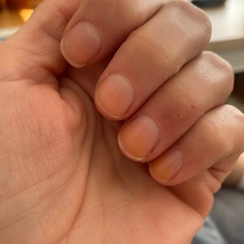 Flormar Oje Sonrası Tırnak Sorunu