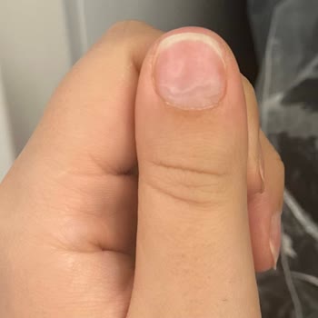 Tırnak Bakımında Hayal Kırıklığı Ve Sağlık Sorunları