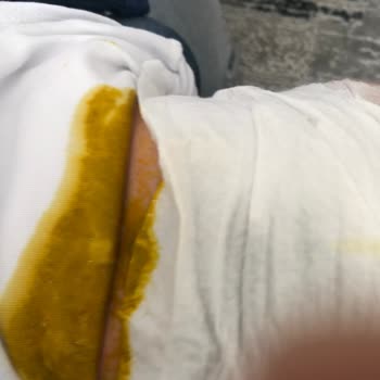 Prima Bebek Bezi Hayal Kırıklığı