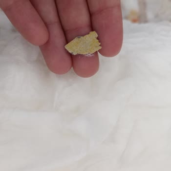 Bebek Bezi İçinde Bulunan Yabancı Madde Sorunu