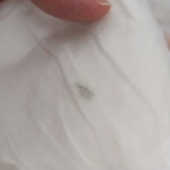 Bebek Bezi İçinde Bulunan Yabancı Madde Sorunu