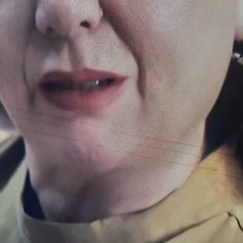 Samsung Televizyonlarda Ekran Sorunu Ve Garanti Sıkıntısı