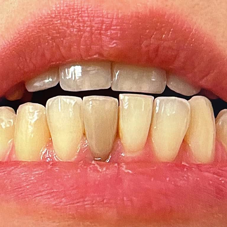 Medicadent Ağız Ve Diş Sağlığı Polikliniği Ortodontik Tedavide Büyük Hayal Kırıklığı Ve İlgisizlik