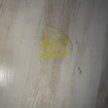 Aptamil Mama Sonrası Ciddi Sağlık Sorunları