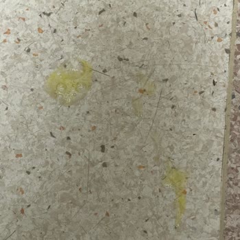 Aptamil Mama Sonrası Ciddi Sağlık Sorunları