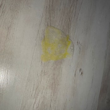 Bozuk Mama Nedeniyle Yaşanan Sağlık Sorunları