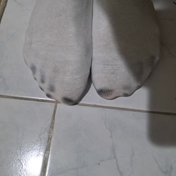 Boyası Akan Ayakkabı Ve Yetersiz Müşteri Hizmeti