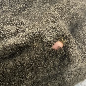 Eksik Ve Defolu Ürünlerle Mağduriyet