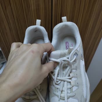 Skechers Ayakkabıda Beklenmedik Aşınma Sorunu