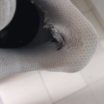 Adidas Ayakkabılarında Sürekli Yaşanan Sorunlar