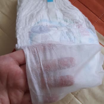 Molfix Külot Bezde Yabancı Madde Sorunu