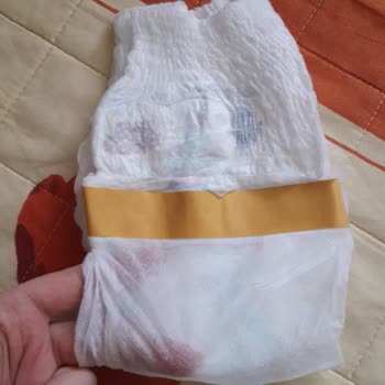 Molfix Külot Bezde Yabancı Madde Sorunu