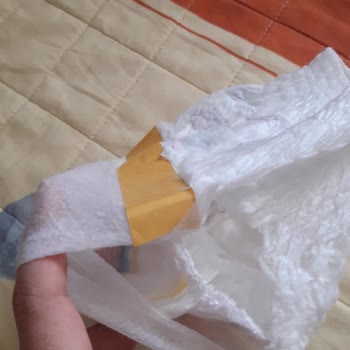 Molfix Külot Bezde Yabancı Madde Sorunu