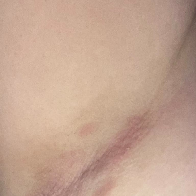 Alerji Yapan Roll-On Kabusu