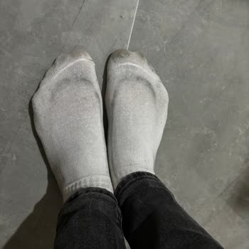 Adidas Ayakkabıda Renk Verme Sorunu