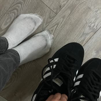 Adidas Ayakkabıda Renk Verme Sorunu