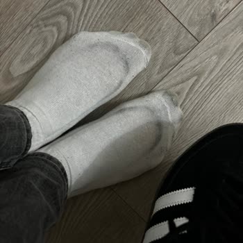 Adidas Ayakkabıda Renk Verme Sorunu