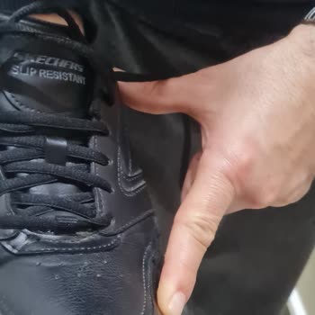 Skechers Ayakkabıda Erken Açılma Sorunu
