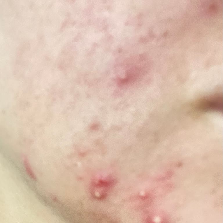 Cilt Bakımında Hayal Kırıklığı Ve İlgisizlik