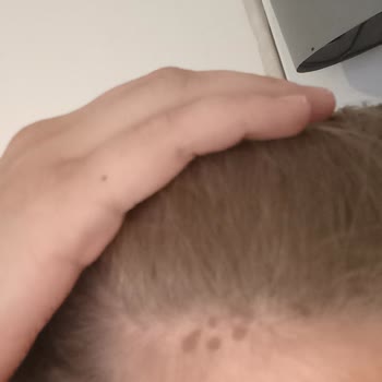 Palette 10.1 İle Saç Derimde Yanık Şoku!