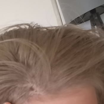 Palette 10.1 İle Saç Derimde Yanık Şoku!