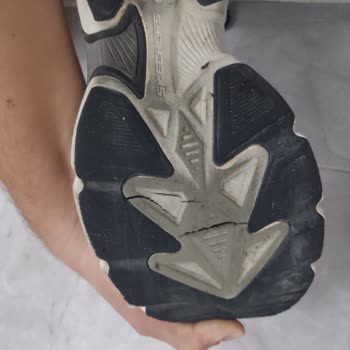 Skechers Ayakkabıda Kalite Sorunu Ve Garanti Mağduriyeti