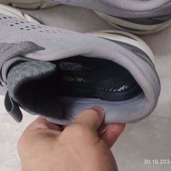 Skechers Ayakkabıda Kalite Sorunu Ve Garanti Mağduriyeti