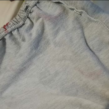 Molfix Bebek Bezinde Sürekli Sızıntı Sorunu