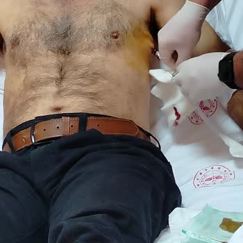 Hastane İhmali: Hayati Tehlikeye Rağmen Yetersiz Hizmet