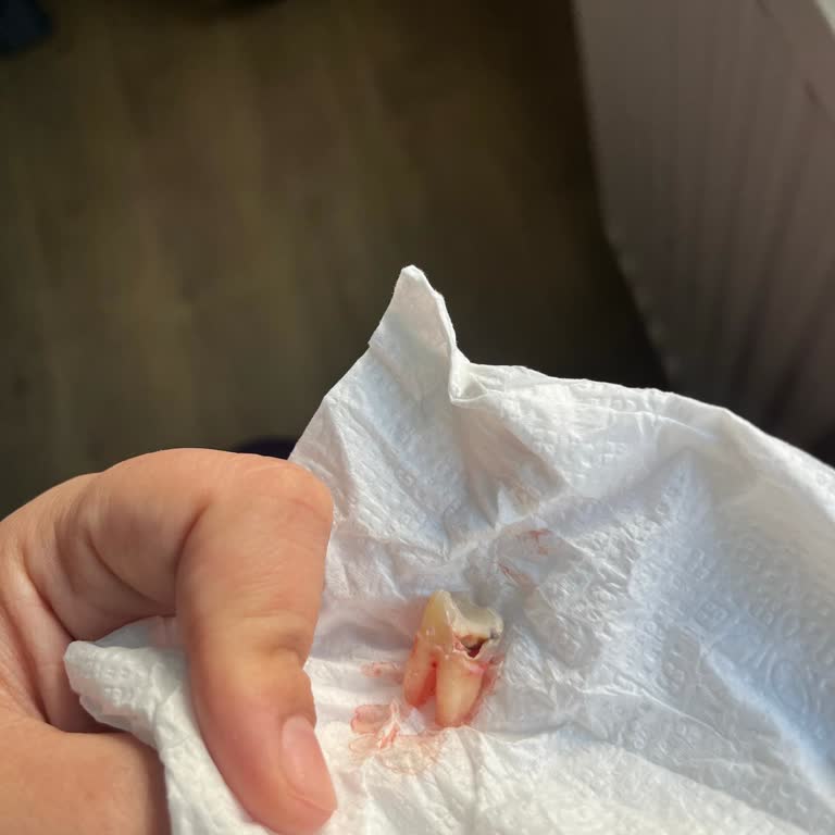 Menemen Ağız Ve Diş Sağlığı Merkezi Dolgu İşlemi Başarısızlığı!