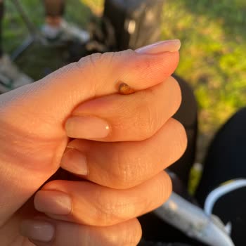 Çikolatanın İçinden Çıkan Sert Cisim Şoku