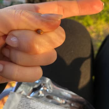 Çikolatanın İçinden Çıkan Sert Cisim Şoku