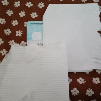 Kimlik Kartı Çip Problemi Ve Ücretsiz Değişim Talebi