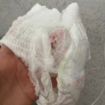 Molfix Bebek Bezinde Üretim Hatası