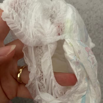 Molfix Bebek Bezinde Üretim Hatası