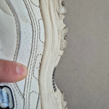 Skechers Ayakkabıda Beklenmedik Açılma Sorunu