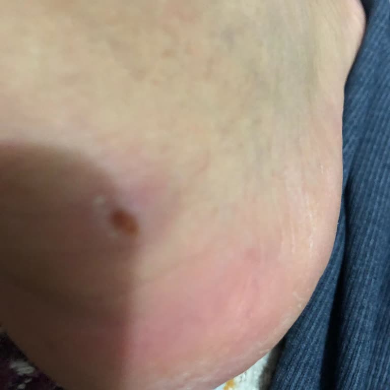 Ayakkabıda Üretim Hatası Ve Boyner'in Yetersiz Çözümü