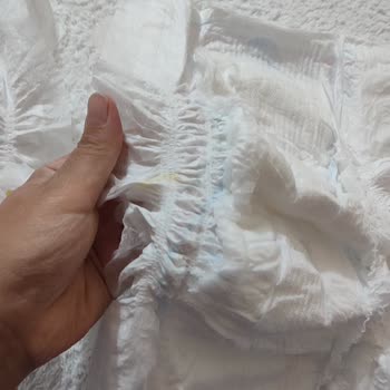 Molfix Bebek Bezinde Yanlış Yapılmış Bariyer Sorunu
