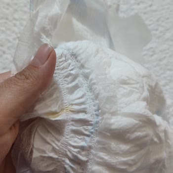Molfix Bebek Bezinde Yanlış Yapılmış Bariyer Sorunu