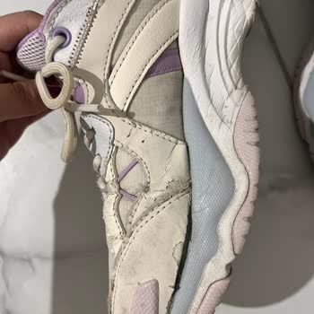 Skechers Ayakkabıda Kalite Sorunu Ve Müşteri Memnuniyetsizliği