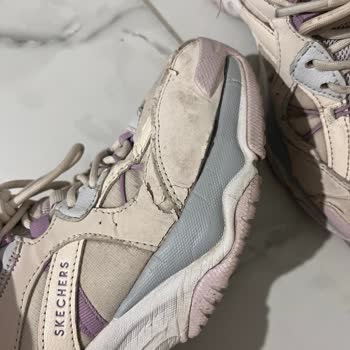 Skechers Ayakkabıda Kalite Sorunu Ve Müşteri Memnuniyetsizliği