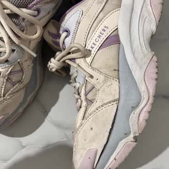 Skechers Ayakkabıda Kalite Sorunu Ve Müşteri Memnuniyetsizliği