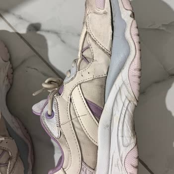 Skechers Ayakkabıda Kalite Sorunu Ve Müşteri Memnuniyetsizliği