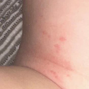 Sleepy Bebek Bezinde Kalite Düşüşü Ve Mantar Sorunu