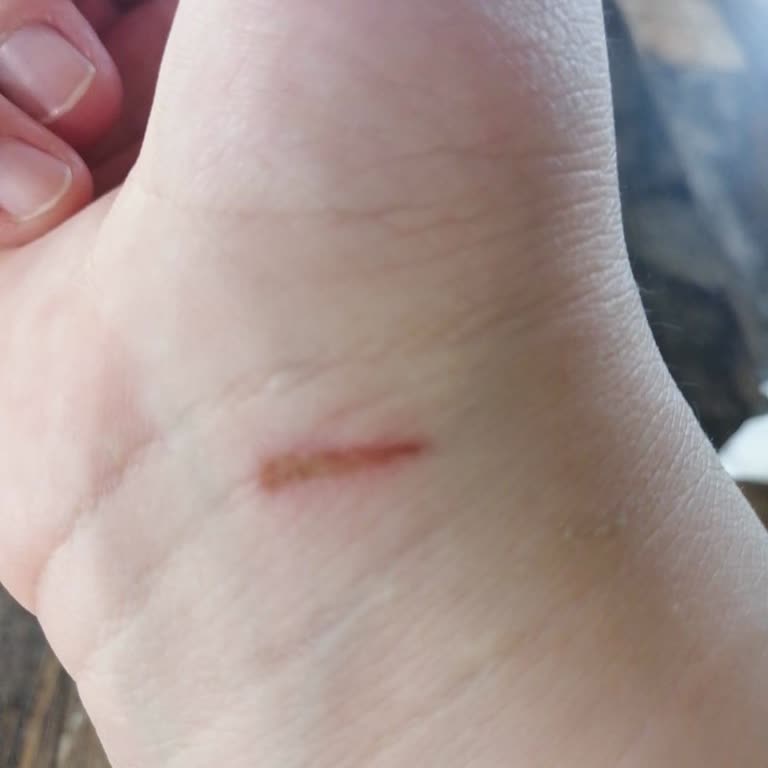 Huzur Kampüs Kız Öğrenci Yurtları 2 Kız Tarafından Saldırıya Uğradım Güvenlik İlgilenmedi!