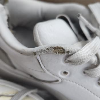 Garanti Kapsamında Çözülmeyen Ayakkabı Sorunları